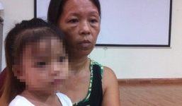 Bé gái 4 tuổi bị teo thực quản do uống nhầm nước tro tàu