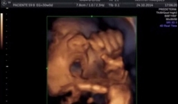 Video: Thai nhi 16 tuần “hát” theo nhạc