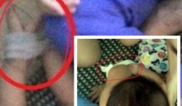 Vụ bé trai 14 tháng bị cô giáo bạo hành: Chủ cơ sở mầm non trần tình