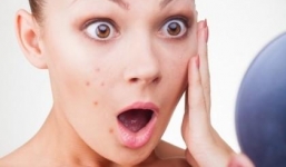 Hiểm họa khôn lường từ chất bảo quản trong mỹ phẩm làm đẹp