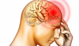 Tìm ra thuốc mới ngăn chặn ung thư não