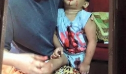 Bức ảnh mẹ ngáo đá đánh con trọng thương không phải ở Việt Nam