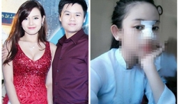 Midu tụt dốc tinh thần vì mối quan hệ tay ba