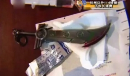 Bị dao đâm vào lưng do tự cắt trĩ tại nhà