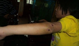 Diễn biến mới vụ bé gái 10 tuổi bị nhốt trong chùa, chằng chịt vết thương