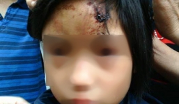 Bé gái 10 tuổi nghi bị trụ trì chùa Thiên Tâm bạo hành