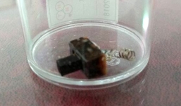 Bé trai 3 tháng tuổi bị hóc… công tắc đèn trong thực quản