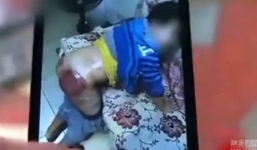 Trung Quốc: Học sinh lớp 4 bị thầy giáo đánh bầm dập mông