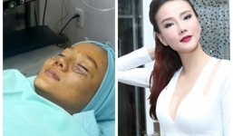 Dương Yến Ngọc 'dao kéo' sau scandal chồng cũ đánh đập