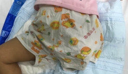 Thương tâm bé 2 tuổi bị máy xay gạo cuốn mất chân