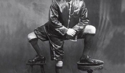 Số phận của những 'dị nhân' 3 đến 4 chân trên thế giới