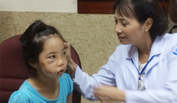 Bé gái 8 tuổi bị chó cắn nát mặt ở Bình Phước