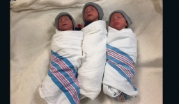 Cặp sinh ba cùng trứng hy hữu