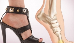 Giày cao gót và những tác hại mà phái đẹp nên biết