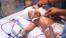  Kết quả giám định thương tật bé 11 ngày tuổi bị đâm xuyên não