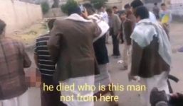 Kẻ đánh bom liều chết IS vẫn còn sống khi bị đứt đôi người