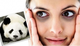 Mẹo đơn giản loại bỏ quầng thâm mắt hiệu quả