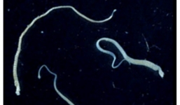 Nam bệnh nhân tử do ung thư vì bị nhiễm sán dây