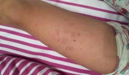 Nữ sinh bị bạn dùng bút sắt đâm vào người ngay trong lớp học