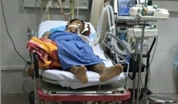 Tài xế taxi đâm hàng loạt xe máy ở cầu vượt Thái Hà đang hôn mê sâu