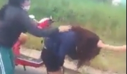 Giám định thương tích nữ sinh bị đánh tuýp sắt vào đầu