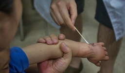 Video: Thót tim cảnh dùng cưa máy để cắt sắt cứu em bé bị kẹt ngón tay