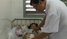 Nữ bệnh nhân sống với khối u 19kg đã được phẫu thuật thành công