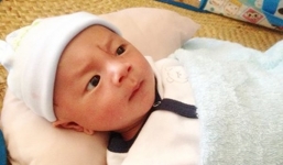 Bé sơ sinh bị đâm xuyên đầu phải nhập viện do viêm màng não