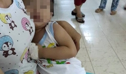 Bé trai 26 tháng tuổi bị 'mổ oan' do bác sĩ chuẩn đoán nhầm 