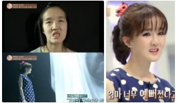 Cô gái khiến chồng không nhận ra sau khi phẫu thuật