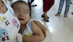Bé trai bị 'mổ nhầm' đang được điều trị viêm hạch