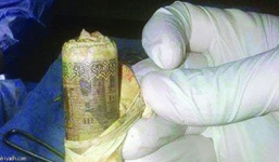 Tin đời sống hot ngày 23/11: Bác sĩ hốt hoảng khi phát hiện bọc tiền trong bụng bệnh nhân