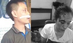 Hà Nội: Hỗn chiến trong quán lẩu, 1 cụ ông tử vong