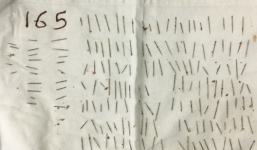 Phẫu thuật, rút 165 cây kim từ vai một phụ nữ