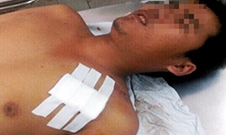 Một cảnh sát cơ động bị đâm trọng thương khi chống đua xe