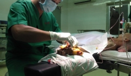 Phẫu thuật cắt khối u khủng nặng hơn 4kg thành công