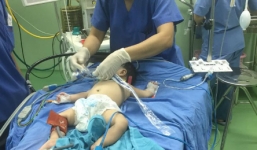 Kỳ lạ bé sơ sinh có hai bộ phận sinh dục