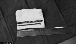 Hãi hùng thanh niên nhiễm khuẩn ổ bụng, thủng dạ dày vì nuốt đinh, lưỡi cưa