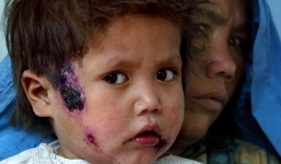 IS vứt xác người bừa bãi làm lan truyền “bệnh ăn thịt”