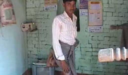 Dị nhân 4 chân bị cả làng hắt hủi ở Ấn Độ