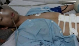 Vì cái ghế nhựa, nam sinh rút dao đâm lớp trưởng lớp 9 trọng thương