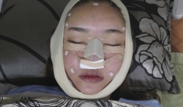 Hé lộ nguyên nhân mặt Kỳ Hân sưng vù tại sự kiện