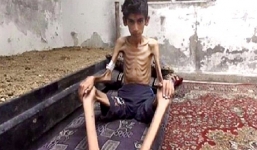 Thảm cảnh khốn cùng của người dân Syria trong vùng chiến sự 