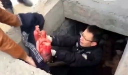 Bé sơ sinh bị bỏ ở ống cống ở nhiệt độ -16 độ sống sót thần kỳ