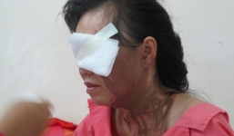 Đang chở con gái đi học, người phụ nữ bị tạt axit giữa trung tâm Sài Gòn