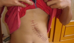 Hà Nội: Tài xế taxi môi giới mua, bán thận 300 triệu đồng