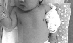 Bé gái 4 tuổi đánh gãy tay em trai mới sinh vì bị trêu 'ra rìa'