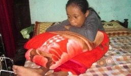 Sự thật bất ngờ về cô gái hơn 10 năm ngủ ngồi