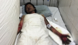 Tình tiết bất ngờ vụ đôi nam nữ cháy đen trong phòng trọ