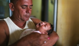 Virus Zika gây nhỏ đầu có thể xâm nhập vào Việt Nam